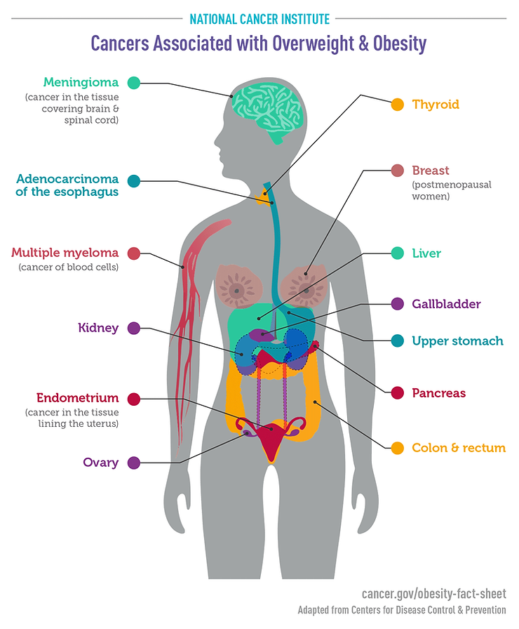 Obesity is linked to 13 cancer types (National Cancer Institute. Obesity and Cancer Risk)